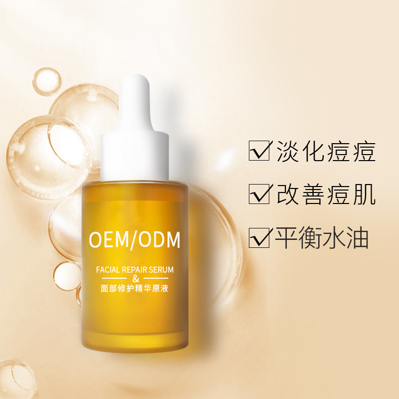 怒江傈僳族自治州_祛痘精华原液OEM